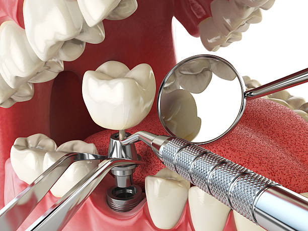 Best Emergency Tooth Extraction  in Columbus, TX
